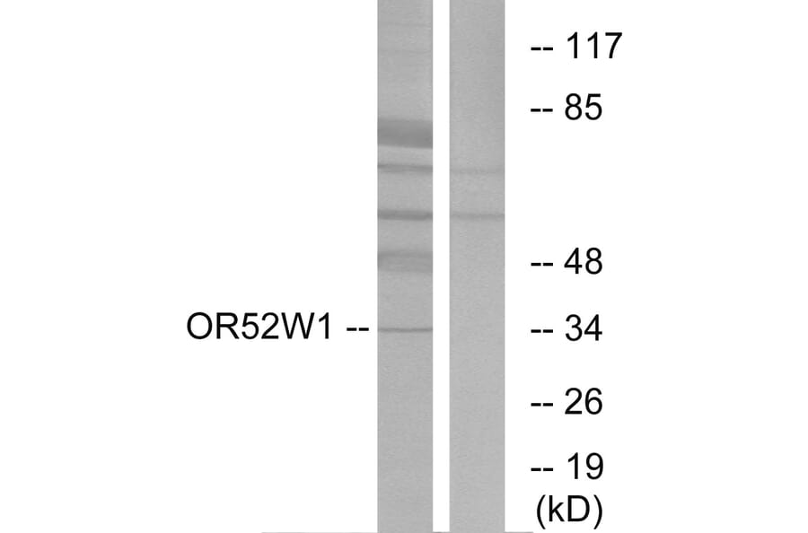 Western Blot - Anti-OR52W1 Antibody (G466) - Antibodies.com