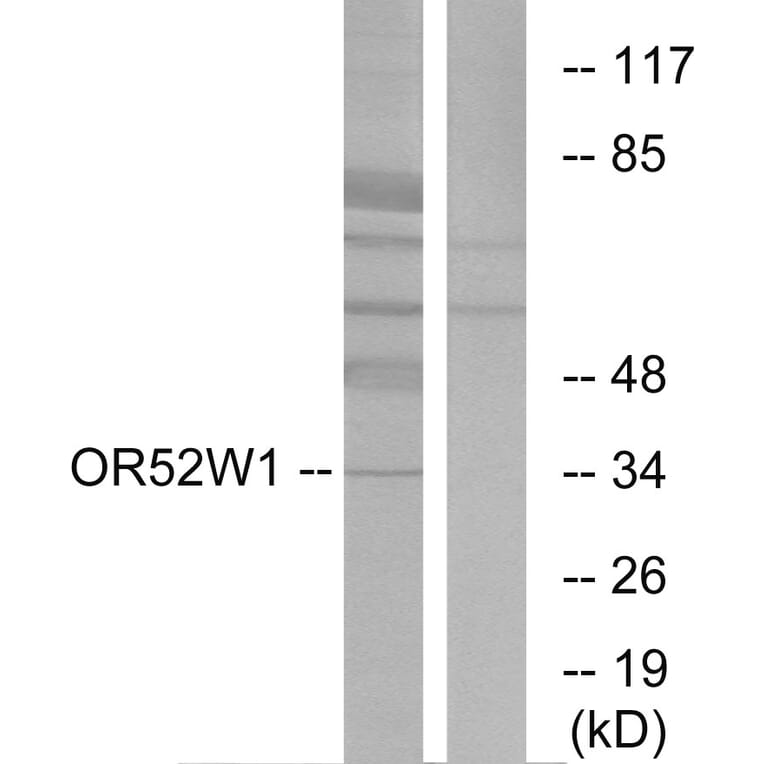 Western Blot - Anti-OR52W1 Antibody (G466) - Antibodies.com