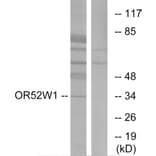 Western Blot - Anti-OR52W1 Antibody (G466) - Antibodies.com