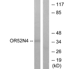 Western Blot - Anti-OR52N4 Antibody (G465) - Antibodies.com