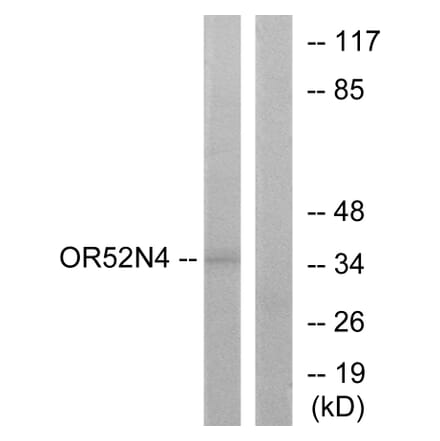 Western Blot - Anti-OR52N4 Antibody (G465) - Antibodies.com