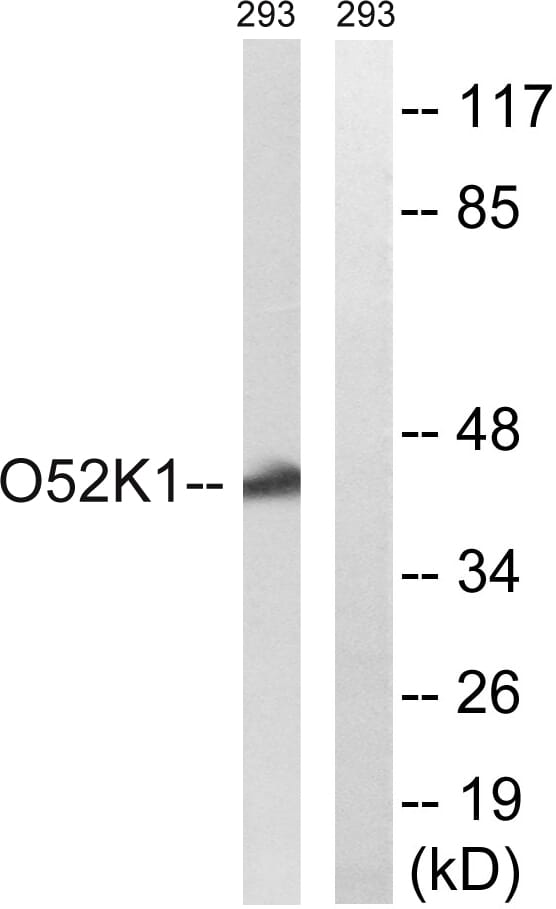 Western blot analysis of lysates from 293 cells using Anti-OR52K1 Antibody. The right hand lane represents a negative control, where the antibody is blocked by the immunising peptide.