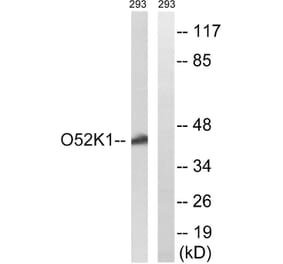 Western Blot - Anti-OR52K1 Antibody (G858) - Antibodies.com