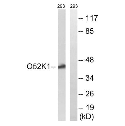 Western Blot - Anti-OR52K1 Antibody (G858) - Antibodies.com