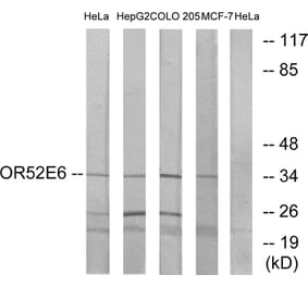 Western Blot - Anti-OR52E6 Antibody (G462) - Antibodies.com