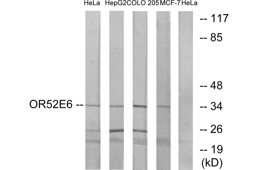 Western Blot - Anti-OR52E6 Antibody (G462) - Antibodies.com