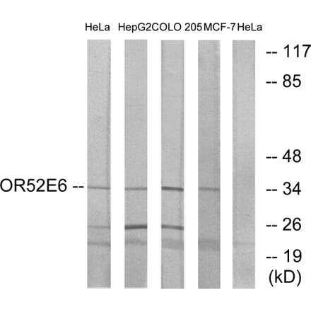 Western Blot - Anti-OR52E6 Antibody (G462) - Antibodies.com