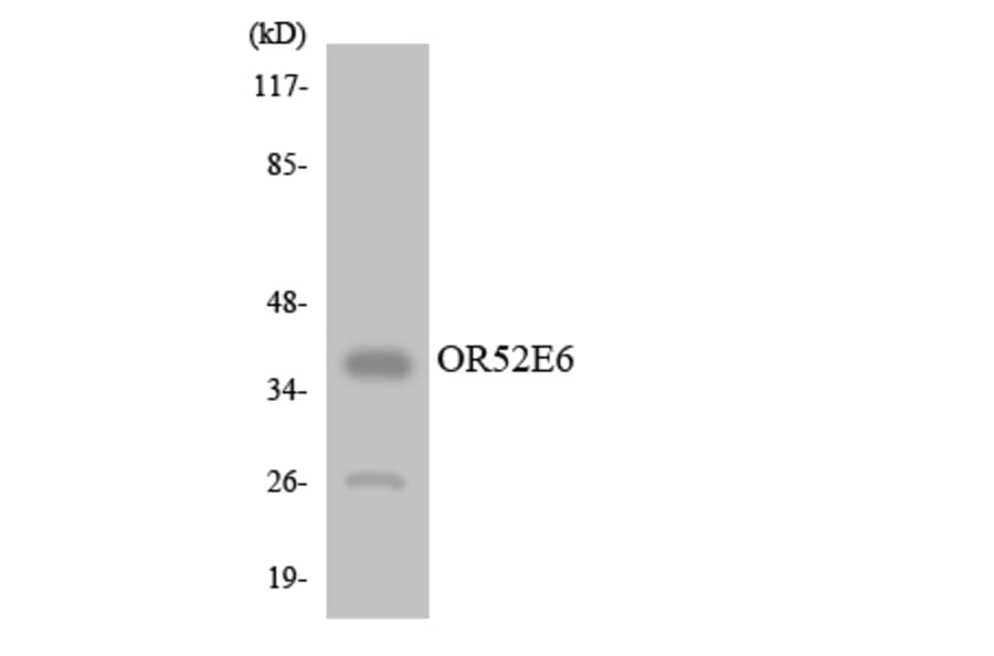 Western Blot - Anti-OR52E6 Antibody (R12-3221) - Antibodies.com