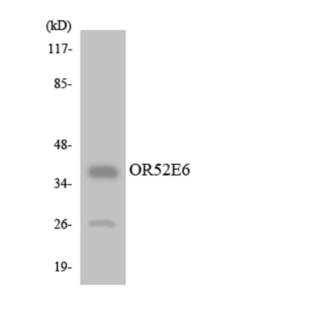 Western Blot - Anti-OR52E6 Antibody (R12-3221) - Antibodies.com