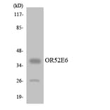 Western Blot - Anti-OR52E6 Antibody (R12-3221) - Antibodies.com