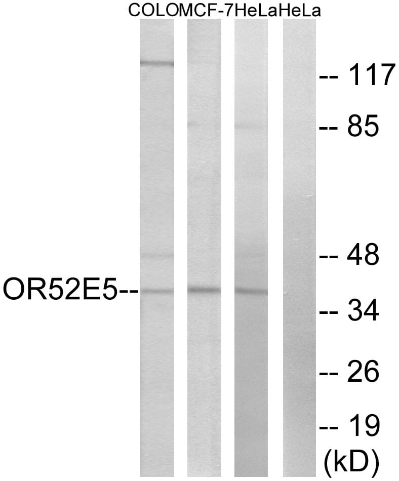 Western blot analysis of lysates from COLO, MCF-7, and HeLa cells using Anti-OR52E5 Antibody. The right hand lane represents a negative control, where the antibody is blocked by the immunising peptide.