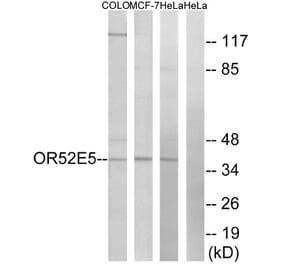 Western Blot - Anti-OR52E5 Antibody (G854) - Antibodies.com