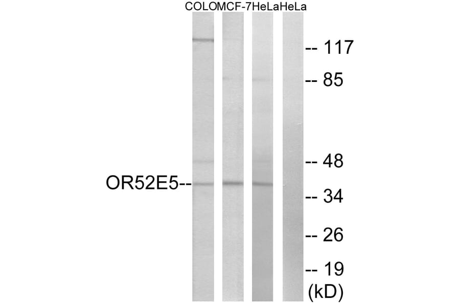Western Blot - Anti-OR52E5 Antibody (G854) - Antibodies.com