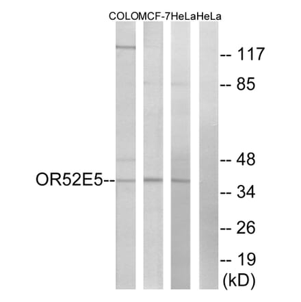 Western Blot - Anti-OR52E5 Antibody (G854) - Antibodies.com