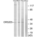 Western Blot - Anti-OR52E5 Antibody (G854) - Antibodies.com