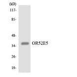 Western Blot - Anti-OR52E5 Antibody (R12-3220) - Antibodies.com