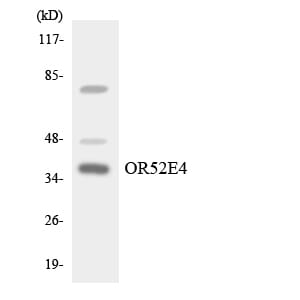 Western blot analysis of the lysates from HT 29 cells using Anti-OR52E4 Antibody.