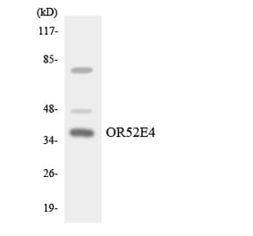 Western Blot - Anti-OR52E4 Antibody (R12-3219) - Antibodies.com