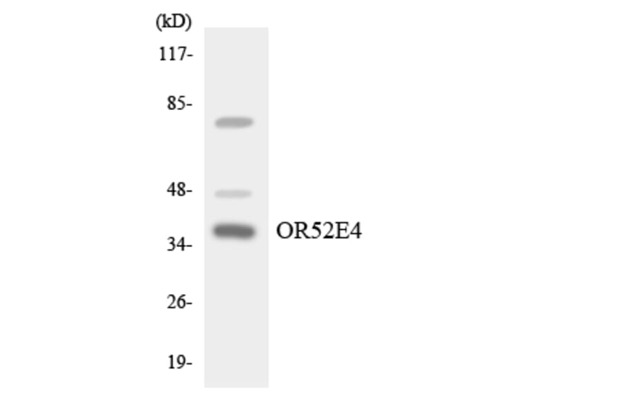Western Blot - Anti-OR52E4 Antibody (R12-3219) - Antibodies.com