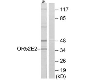 Western Blot - Anti-OR52E2 Antibody (G461) - Antibodies.com