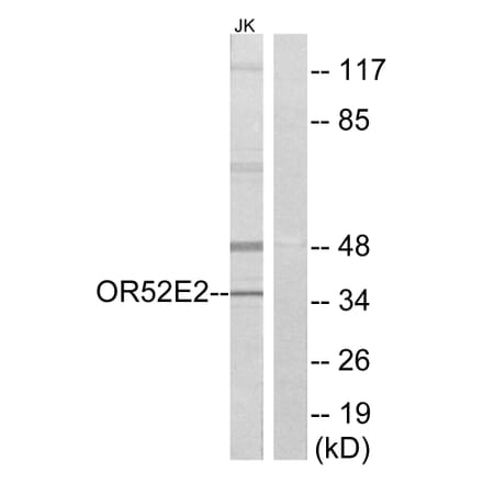 Western Blot - Anti-OR52E2 Antibody (G461) - Antibodies.com