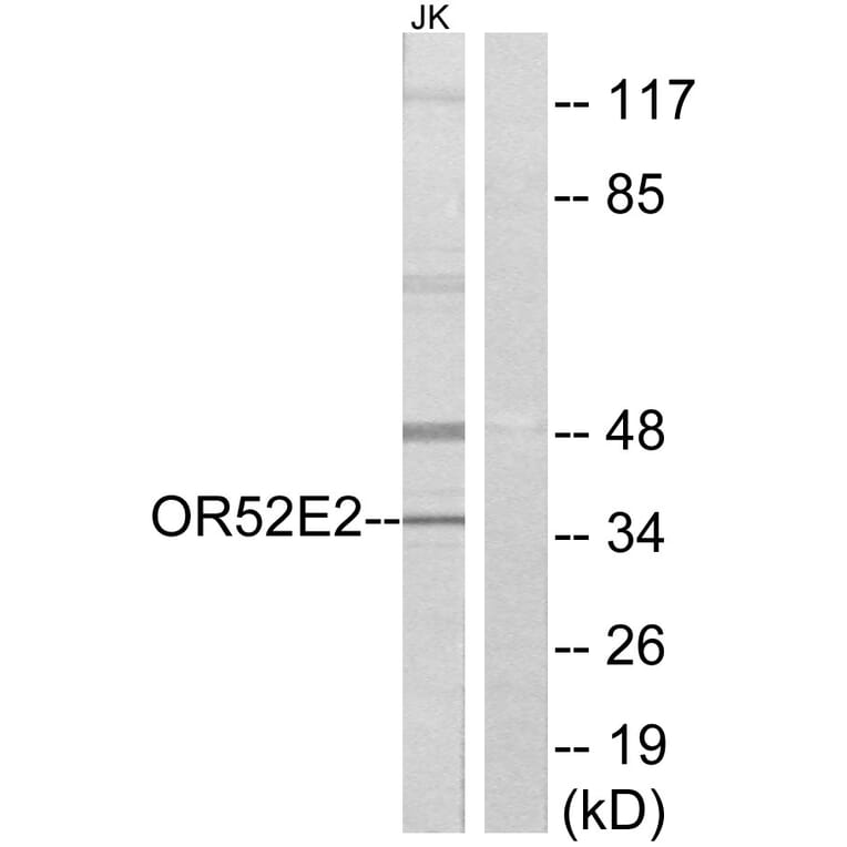 Western Blot - Anti-OR52E2 Antibody (G461) - Antibodies.com