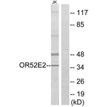 Western Blot - Anti-OR52E2 Antibody (G461) - Antibodies.com