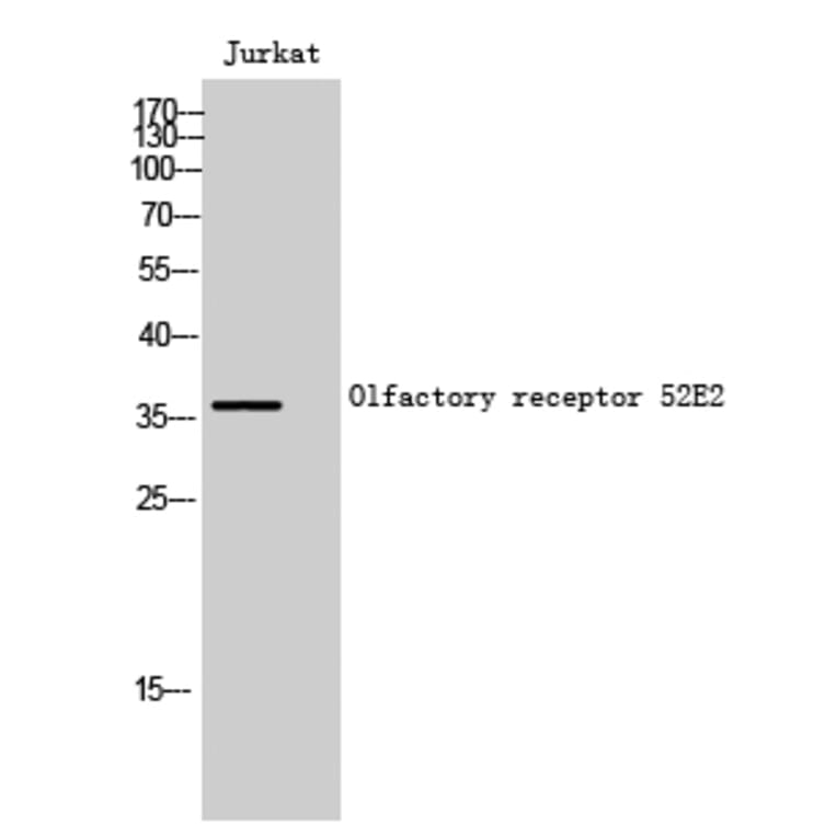 Western Blot - Anti-OR52E2 Antibody (G461) - Antibodies.com