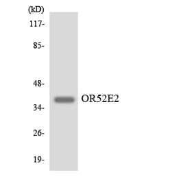 Western Blot - Anti-OR52E2 Antibody (R12-3218) - Antibodies.com