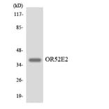 Western Blot - Anti-OR52E2 Antibody (R12-3218) - Antibodies.com