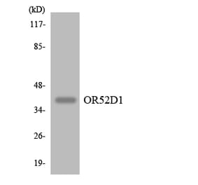 Western Blot - Anti-OR52D1 Antibody (R12-3216) - Antibodies.com