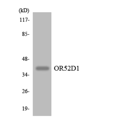 Western Blot - Anti-OR52D1 Antibody (R12-3216) - Antibodies.com