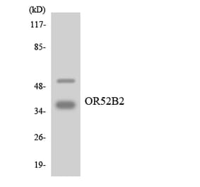Western Blot - Anti-OR52B2 Antibody (R12-3215) - Antibodies.com