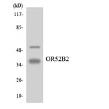 Western Blot - Anti-OR52B2 Antibody (R12-3215) - Antibodies.com