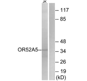 Western Blot - Anti-OR52A5 Antibody (G851) - Antibodies.com