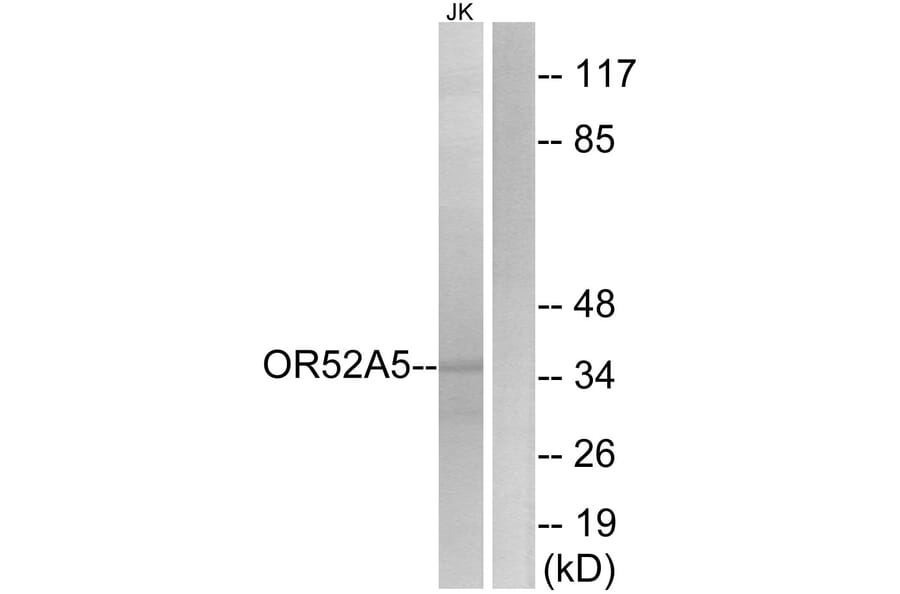 Western Blot - Anti-OR52A5 Antibody (G851) - Antibodies.com
