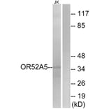 Western Blot - Anti-OR52A5 Antibody (G851) - Antibodies.com