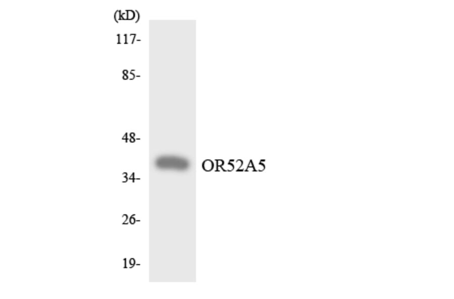 Western Blot - Anti-OR52A5 Antibody (R12-3214) - Antibodies.com