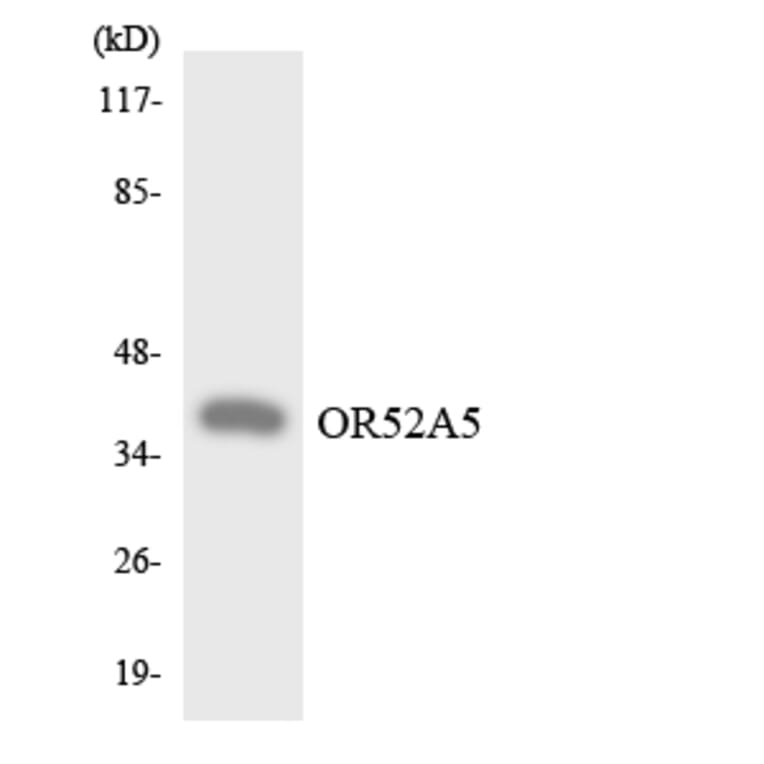 Western Blot - Anti-OR52A5 Antibody (R12-3214) - Antibodies.com