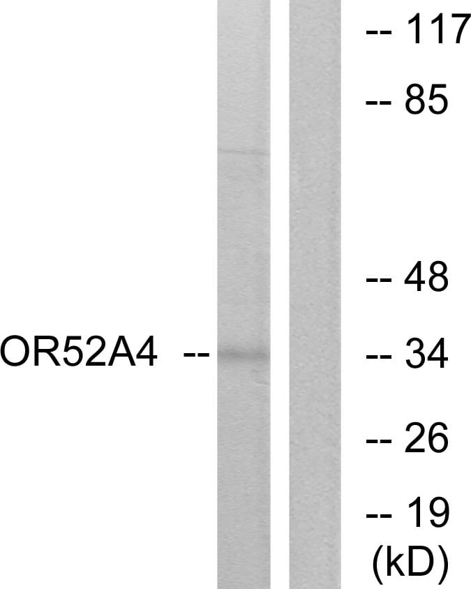 Western blot analysis of lysates from MCF-7 cells using Anti-OR52A4 Antibody. The right hand lane represents a negative control, where the antibody is blocked by the immunising peptide.