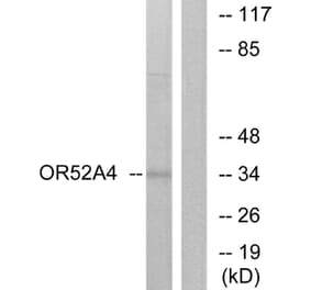 Western Blot - Anti-OR52A4 Antibody (G456) - Antibodies.com