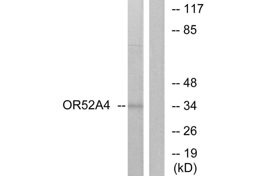 Western Blot - Anti-OR52A4 Antibody (G456) - Antibodies.com