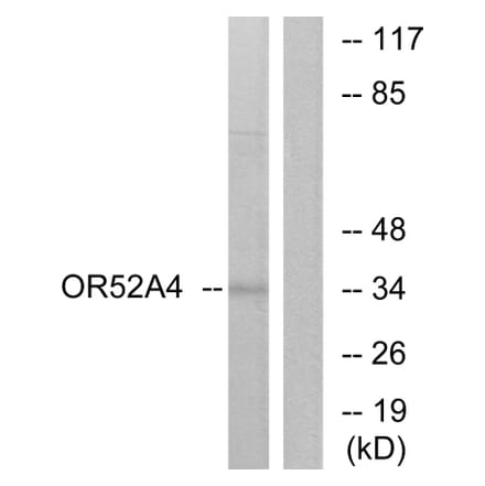 Western Blot - Anti-OR52A4 Antibody (G456) - Antibodies.com