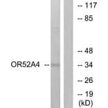 Western Blot - Anti-OR52A4 Antibody (G456) - Antibodies.com