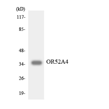 Western Blot - Anti-OR52A4 Antibody (R12-3213) - Antibodies.com