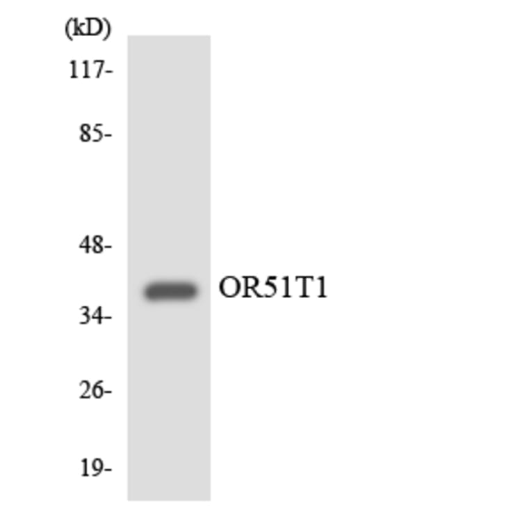 Western Blot - Anti-OR51T1 Antibody (R12-3211) - Antibodies.com
