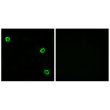 Immunofluorescence - Anti-OR51Q1 Antibody (G453) - Antibodies.com