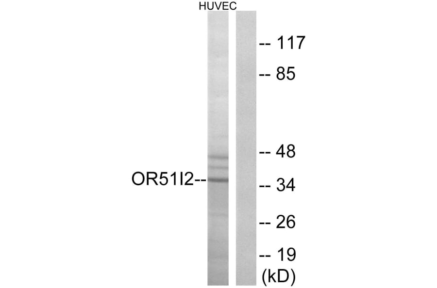 Western Blot - Anti-OR51I2 Antibody (G450) - Antibodies.com