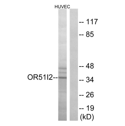 Western Blot - Anti-OR51I2 Antibody (G450) - Antibodies.com