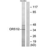 Western Blot - Anti-OR51I2 Antibody (G450) - Antibodies.com